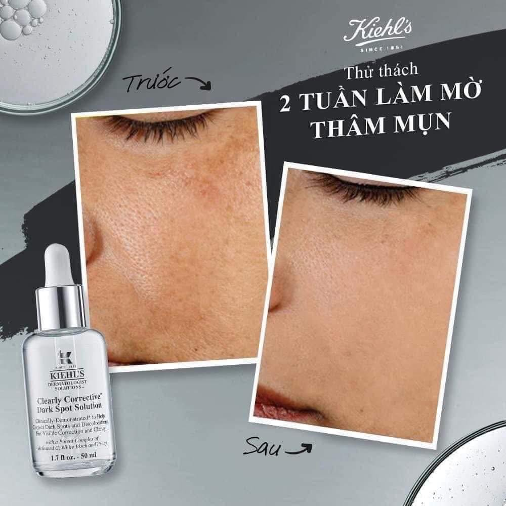 Serum Mờ Thâm Sáng Da Kiehl's The Dark Spot Duo Brightening