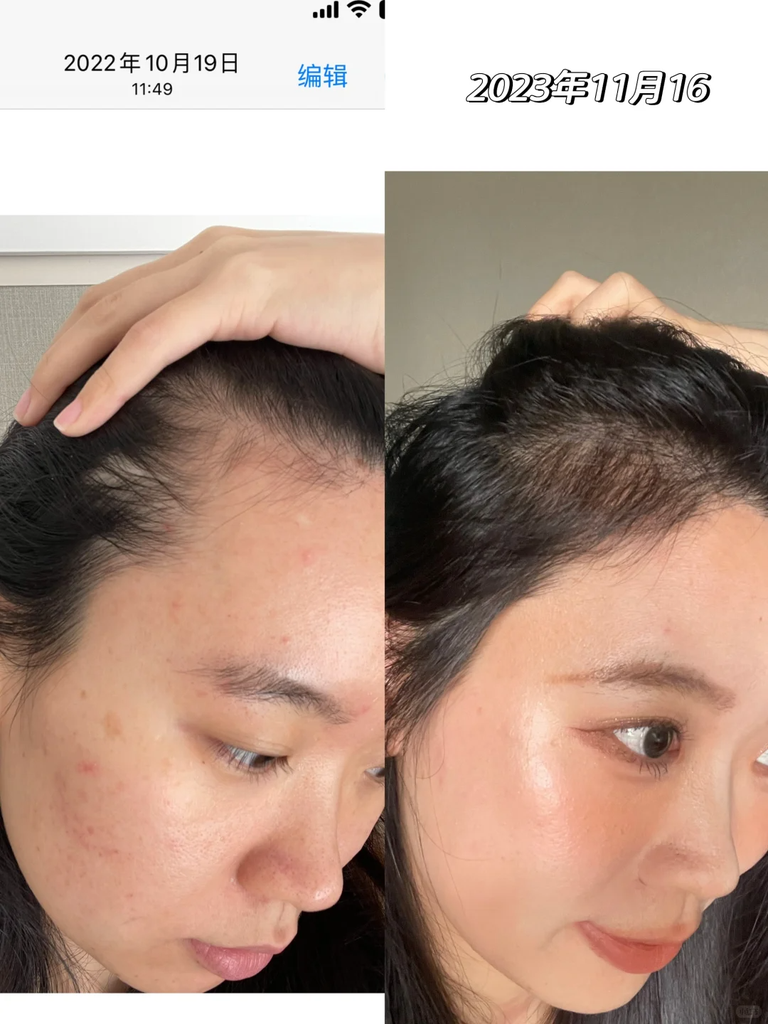 Xịt Mọc Tóc Minoxidil Bailleul Pháp - 60ml