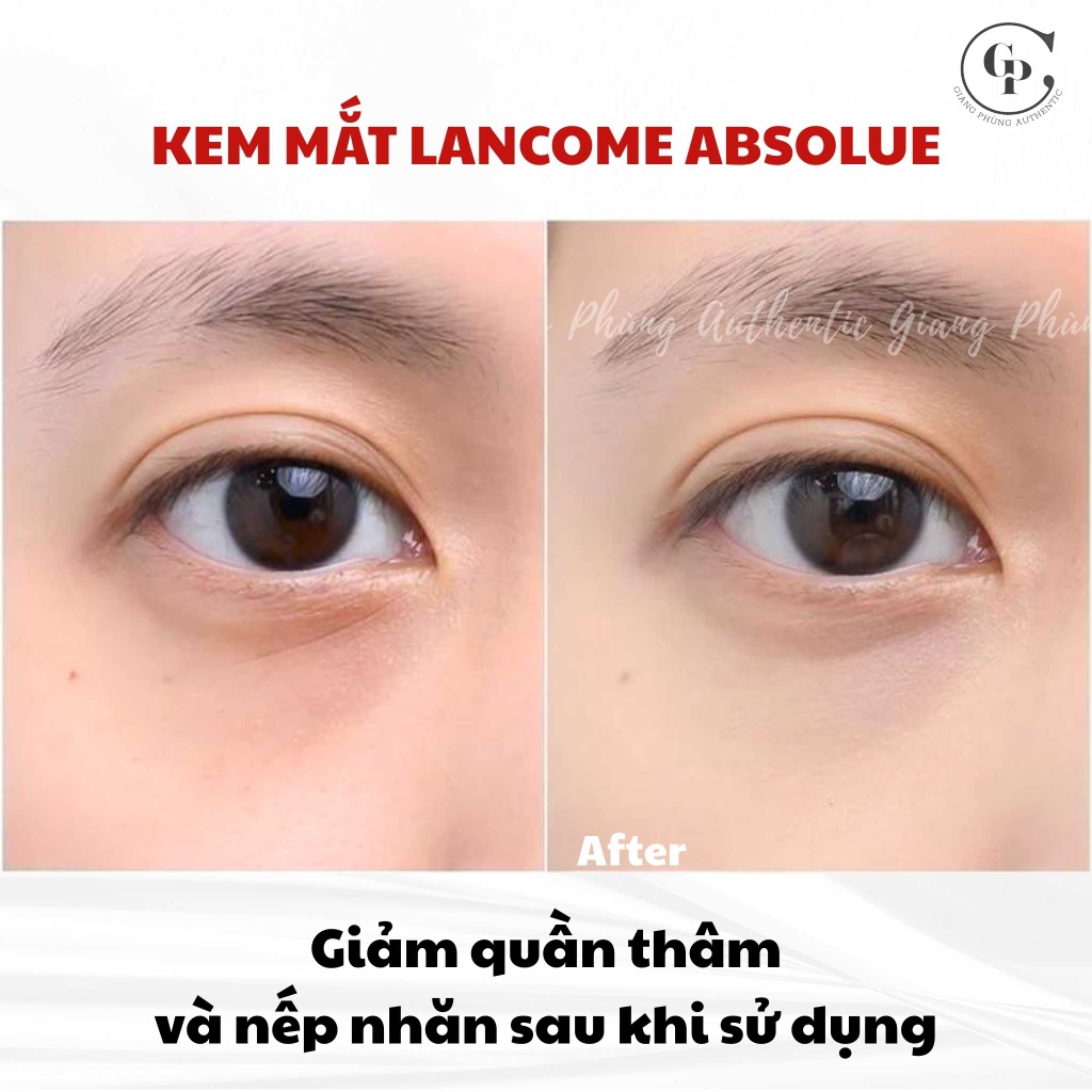 Kem mắt Lancome Absolue 5ml Fullbox - Tách set US