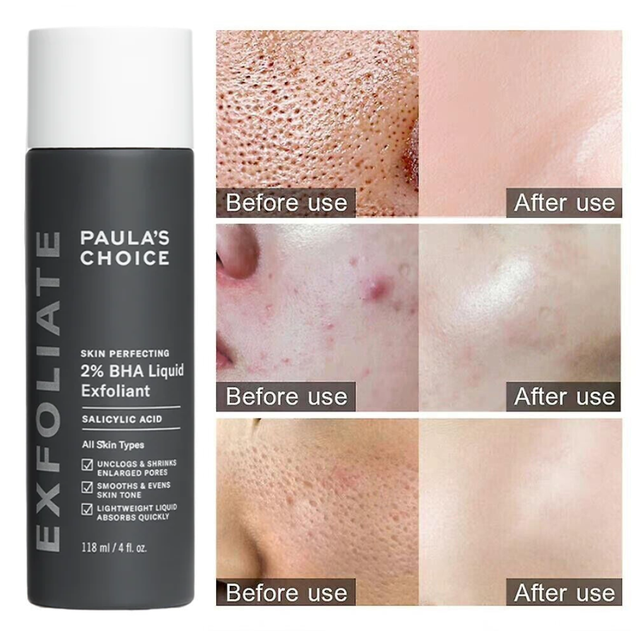 Tẩy Tế Bào Chết Hóa Học Paula’s Choice Skin Perfecting 2% BHA Liquid