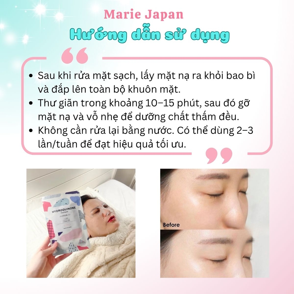 Mặt Nạ Kiso Treatment 5in1 Dưỡng Ẩm Sáng Da Mờ Thâm Căng Mịn Nhật Bản 1 Miếng Lẻ