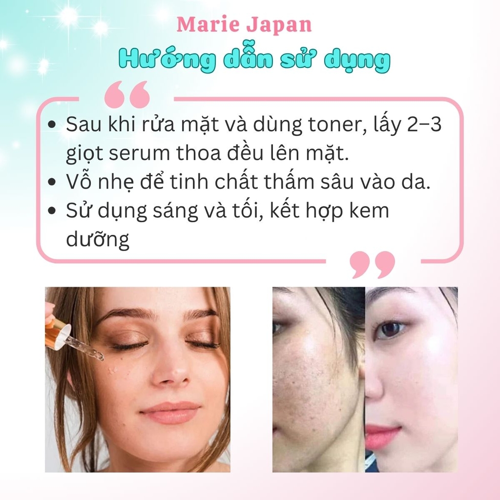 Serum Giảm Nám IKUYO TNA Tranesamix 2% Essence Mờ Thâm Nám Tàn Nhang Dưỡng Trắng Sáng Nhật Bản Chai 30ml