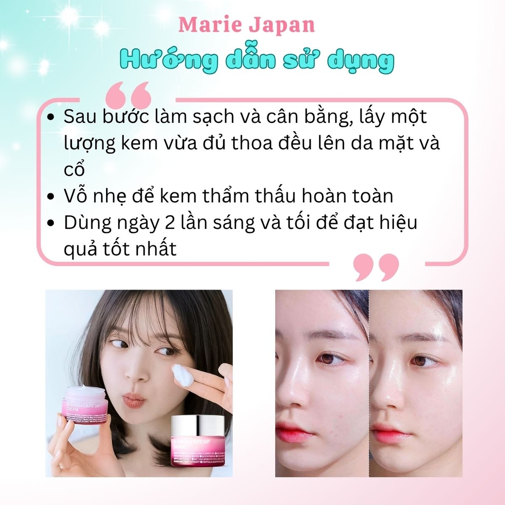 Kem Dưỡng ISOI Blemish Care Up Cream Sáng Da Mờ Thâm Phục Hồi Cấp Ẩm Dịu Nhẹ Hàn Quốc