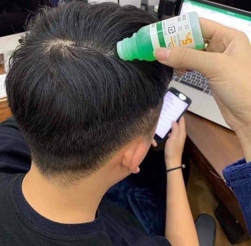 Tinh Chất Chosei Mọc Tóc Nhật Bản Chai 30ml Tặng Kèm Chai Xịt