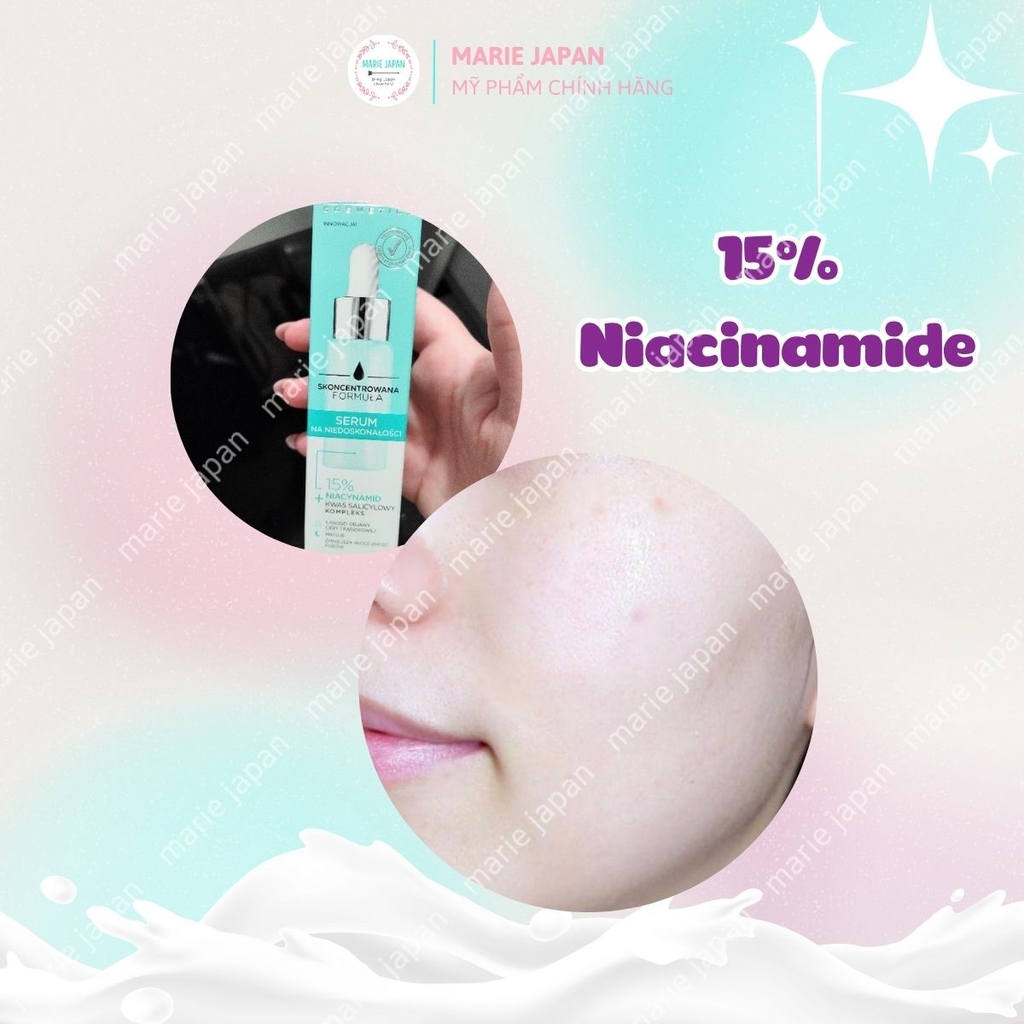 Serum Eveline 15% Niacinamide Concentrated Formula Dưỡng Sáng Mịn Da Mờ Thâm Mụn Chai 18ml