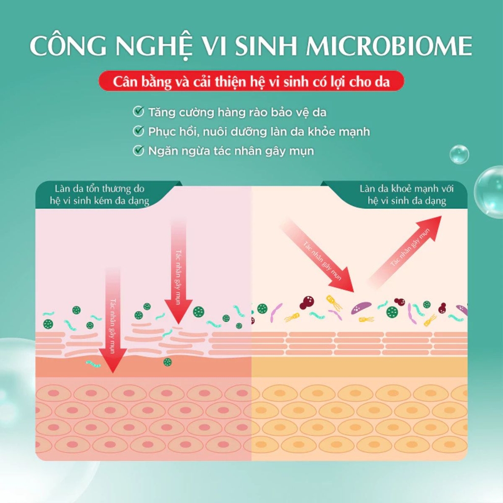 Gel Hada Labo Acne Care Calming Dưỡng Ẩm Sáng Khỏe Cho Da Dầu Mụn Nhạy Cảm 50g