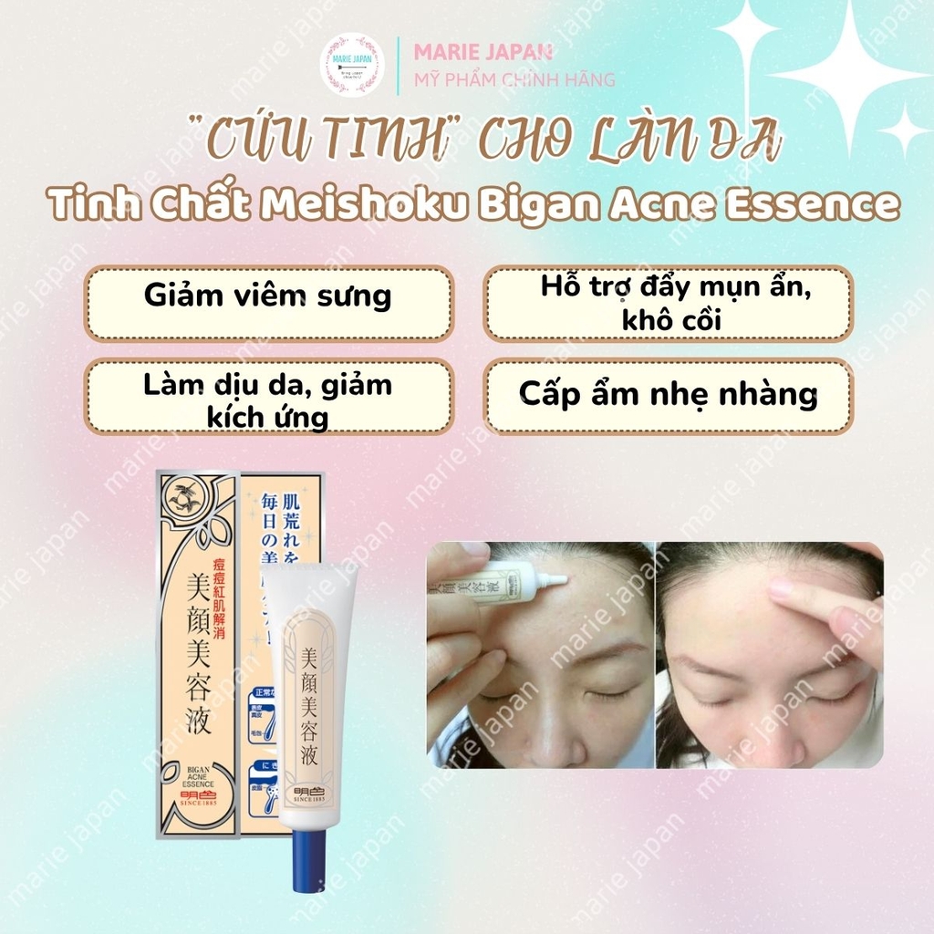 Serum Giảm Mụn Meishoku Bigan Xẹp Mụn Giảm Sưng Viêm Mờ Thâm Nhật Bản Acne Essence Túyp 15g - TẶNG 1 SRM GIẢM MỤN MEISHOKU 15G