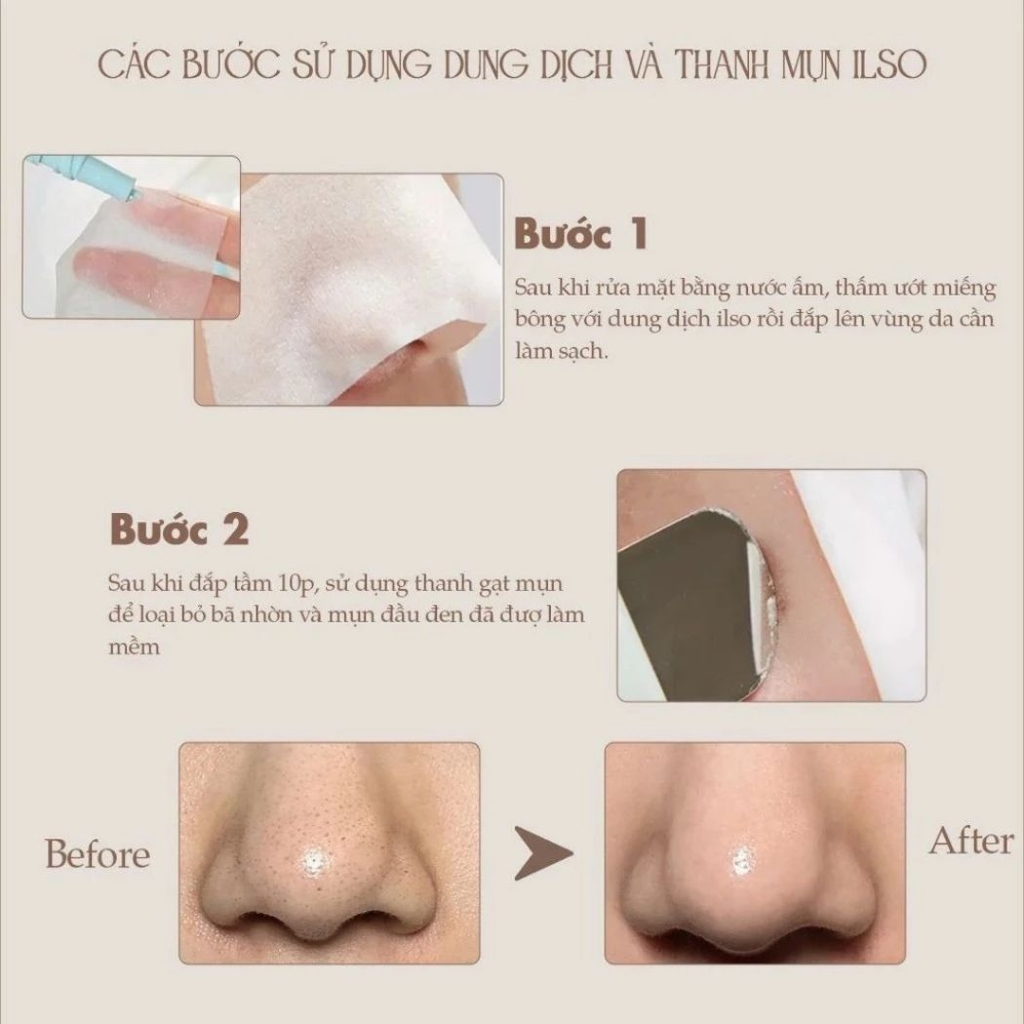 Thanh Đẩy Mụn ILSO Deep Clean Maste Làm Sạch Mụn Đầu Đen Sợi Bã Nhờn Hàn Quốc