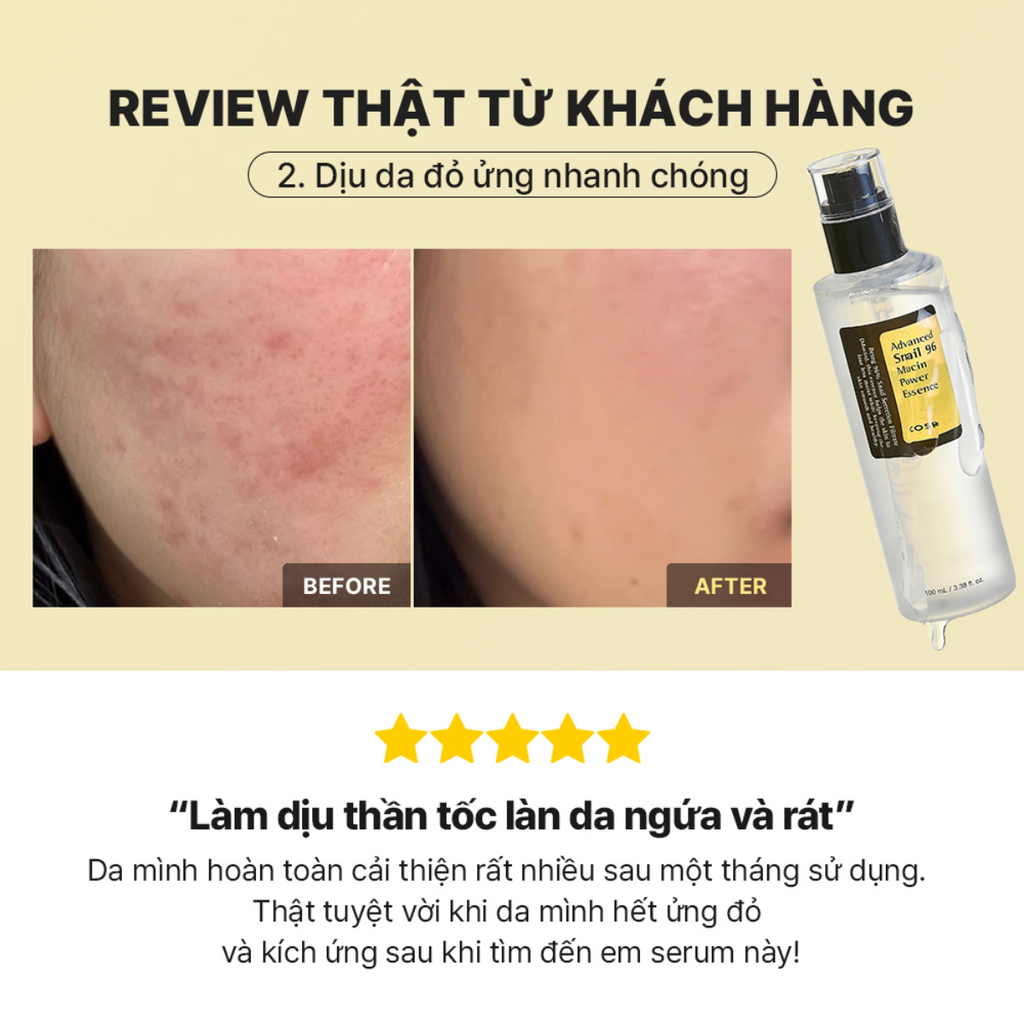 Tinh Chất Ốc Sên Cosrx Advanced Snail 96 Mucin Essence Cấp Ẩm Làm Dịu Phục Hồi Chống Lão Hóa Hàn Quốc 100ml