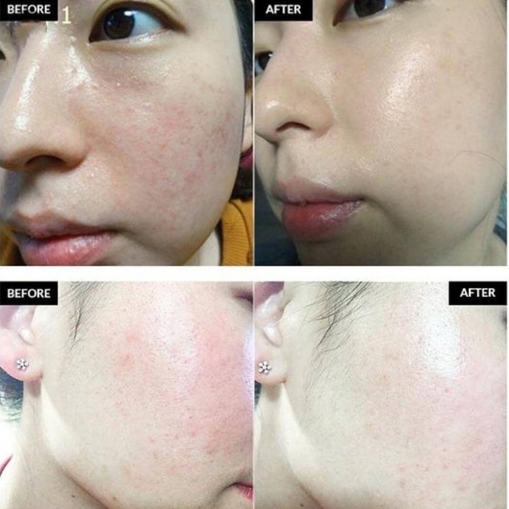 Serum Mediphar+ Hydrating B5 Cấp Ẩm Phục Hồi Dưỡng Sáng Da Hàn Quốc 30ml
