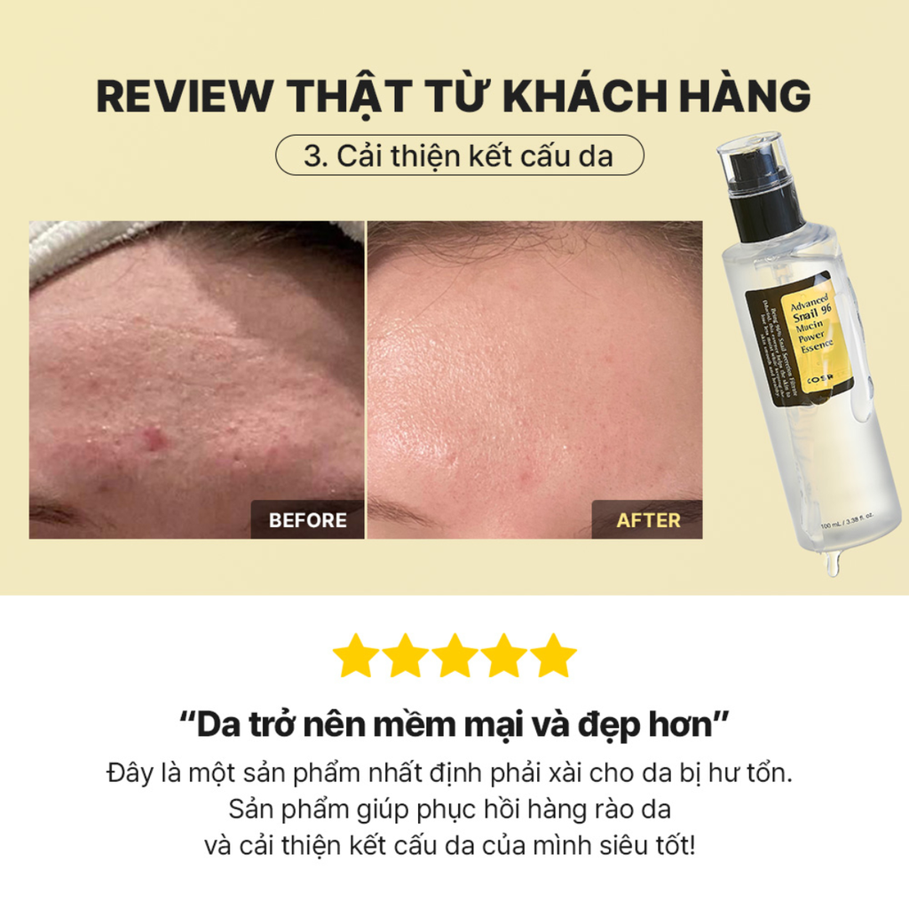 Tinh Chất Ốc Sên Cosrx Advanced Snail 96 Mucin Essence Cấp Ẩm Làm Dịu Phục Hồi Chống Lão Hóa Hàn Quốc 100ml
