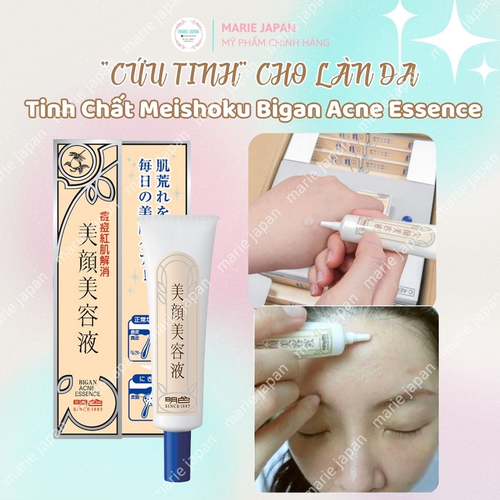 Serum Giảm Mụn Meishoku Bigan Xẹp Mụn Giảm Sưng Viêm Mờ Thâm Nhật Bản Acne Essence Túyp 15g - TẶNG 1 SRM GIẢM MỤN MEISHOKU 15G