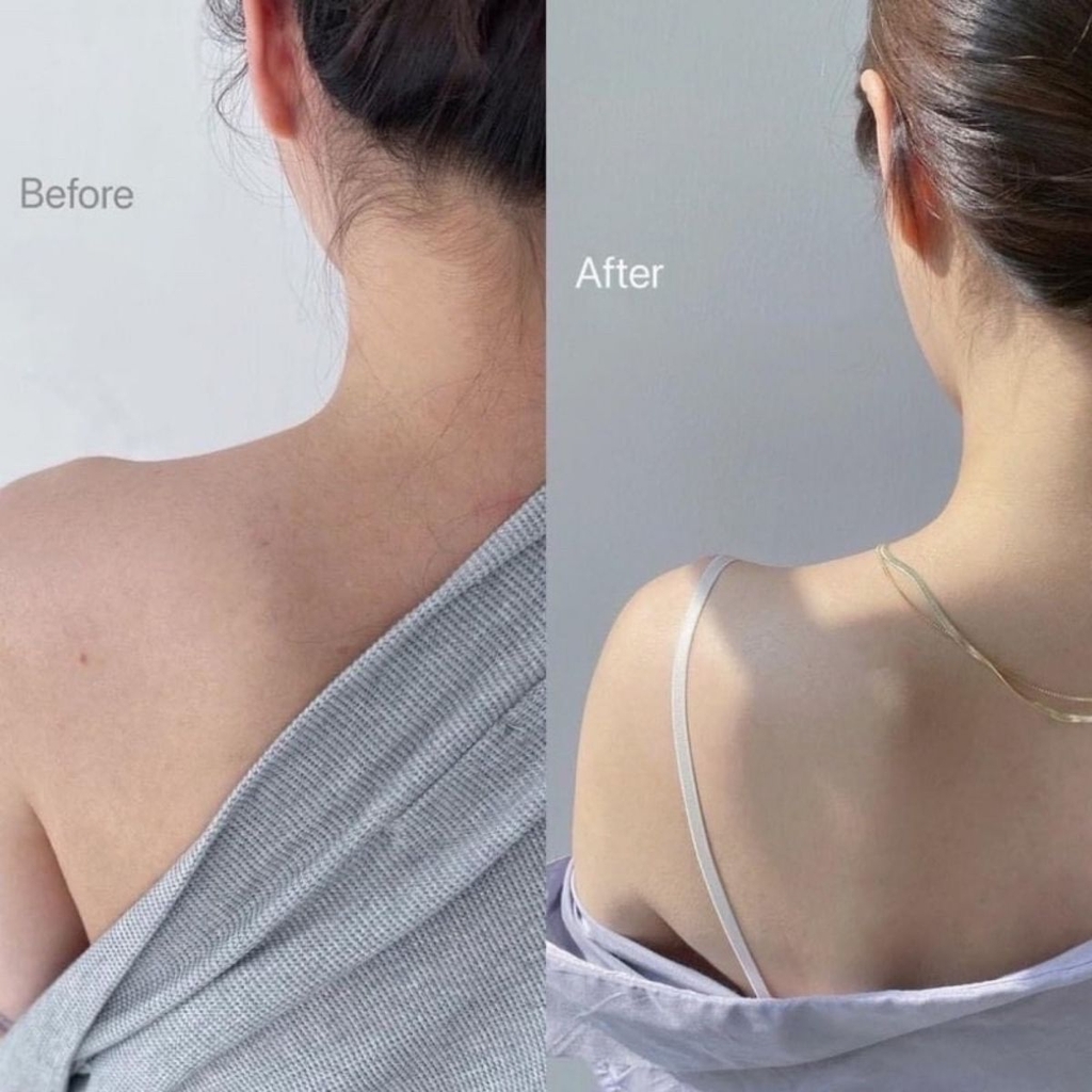 Kem Dưỡng Thể Paula's Choice Weightless Body Treatment 2% BHA Cấp Ẩm Giảm Viêm Lỗ Chân Lông Mỹ