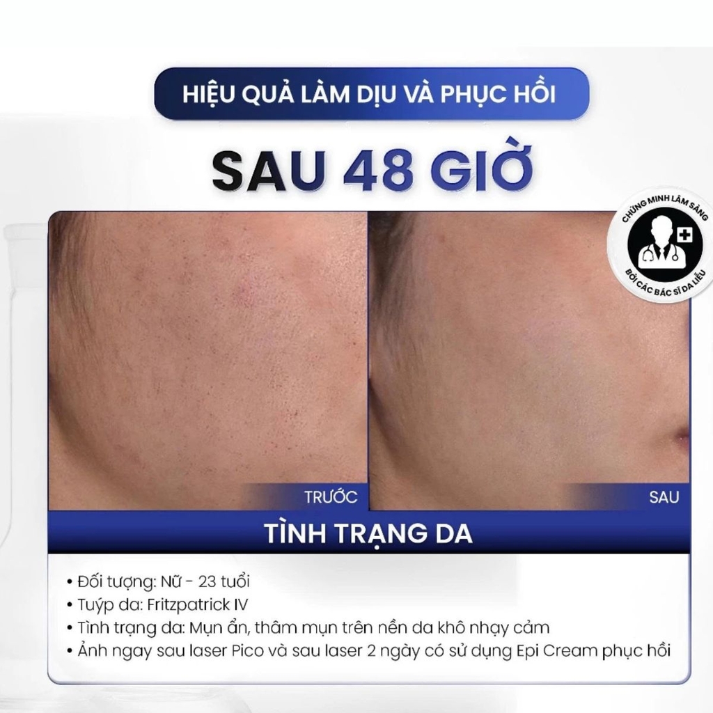 Kem Dưỡng MD CARE Epi - ProCare Dưỡng Ẩm Phục Hồi Cải Thiện  Nếp Nhăn Căng Mịn Da 30ml