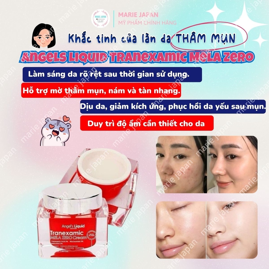 Kem Dưỡng Angel's Liquid Tranexamic Mela Zero Giảm Thâm Nám Dưỡng Trắng Sáng Đều Màu Da Hàn Quốc Chai 30ml