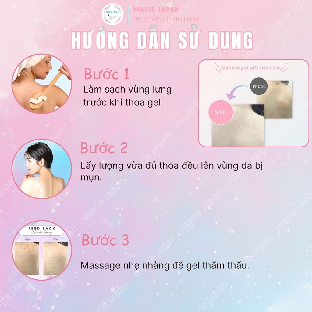 Gel Mụn Lưng Silky Back Whitening & Acne Care Giảm Dầu Mụn Dưỡng Sáng Mờ Thâm Da Nhật Bản  Tuýp 100g