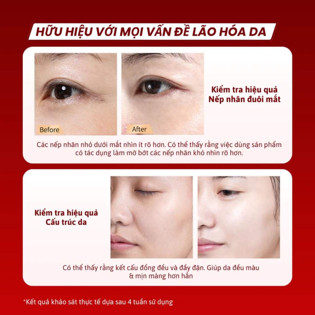 Gel Dưỡng Ẩm Meishoku Harinista Restoration Gel Cream Chống Lão Hóa  Cải Thiện Nếp Nhăn Căng Bóng Da Nhật Bản Hộp 50g