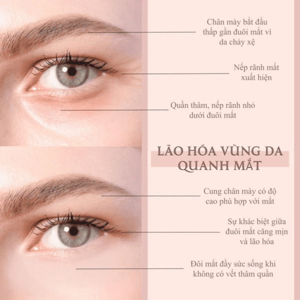 Kem Mắt Biyougeneki Eye Cream Dưỡng Sáng Giảm Thâm  Quầng Mắt Làm Mờ Nếp Nhăn Nhật Bản 20g