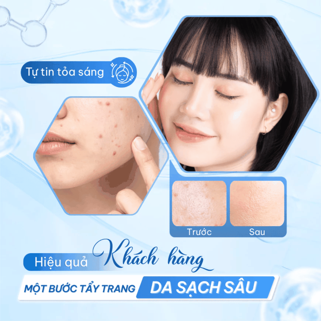 Nước Tẩy Trang Compliment Làm Sạch Sâu Dành Cho Mọi Loại Da Micellar Water Chai 400ml