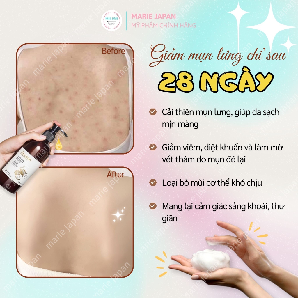 Gel Tắm Bí Đao Cocoon Giúp Giảm Mụn Lưng Winter Melon Shower Chai 310ml