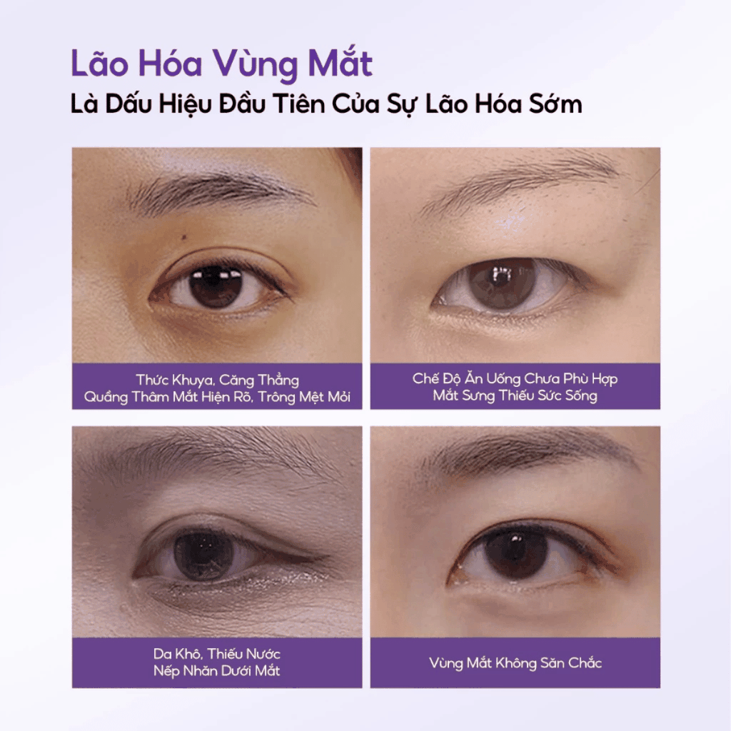 Mặt Nạ Mắt Colorkey Luminous Hỗ Trợ Làm Sáng và Nâng Cơ Vùng Da Mắt  Ginseng Brightening & Uplifting Eye Mask 1 Miếng Lẻ 6g
