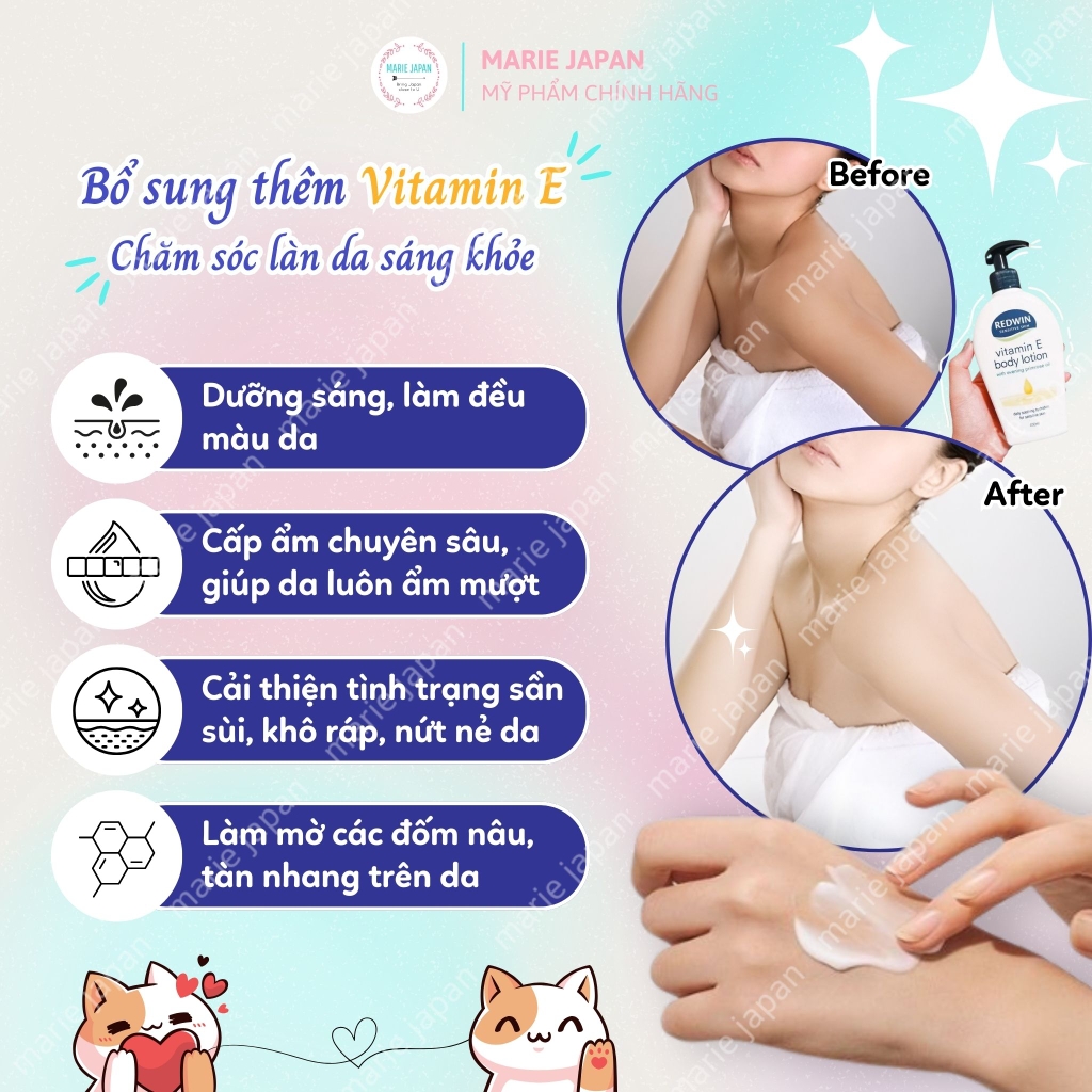 Dưỡng Thể Redwin Vitamin E Sensitive Skin Body Lotion Chai 400ml