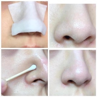Dung Dịch Ủ Mụn Đầu Đen Medi Peel Extra Super 9+ 100ml