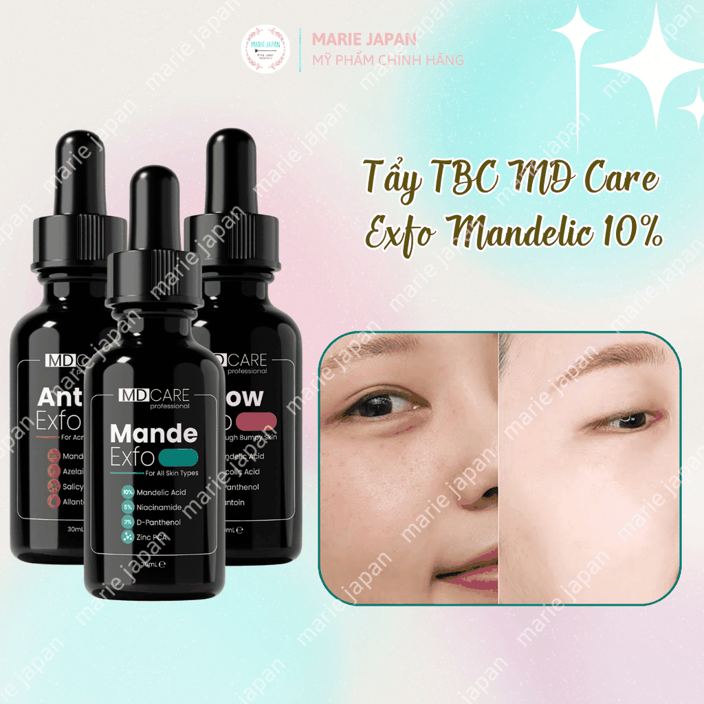 Tẩy Tế Bào Chết MD Care Exfo Mandelic 10%  Sạch Sâu Cấp Ẩm Sáng Da Mờ Thâm 30ML