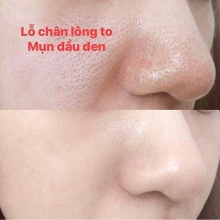 Tinh Chất SQS Siêu Se Khít Lỗ Chân Lông Nhật Bản 15ml