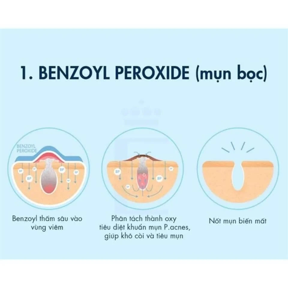 Kem Chấm Mụn Benzac AC5 5% Benzoyl Preoxide Hỗ Trợ Gom Cồi Mụn Giảm Sưng Viêm Hiệu Quả Pháp - Tuýp 15g