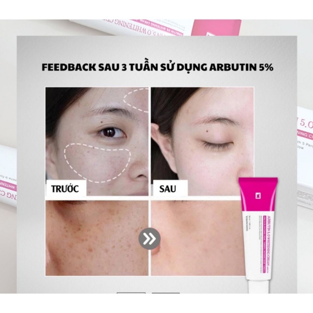 Kem Dưỡng Arbutin 5% Tosowoong Cấp Ẩm Trắng Da Mờ Thâm Nám Hàn Quốc 50ml