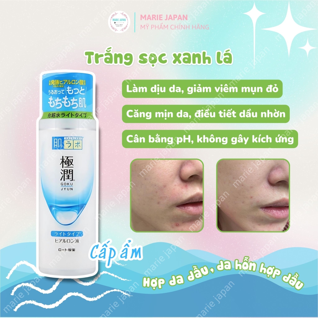 Toner Hada Labo Advanced Nourish Hyaluronic Acid Chai 170ml