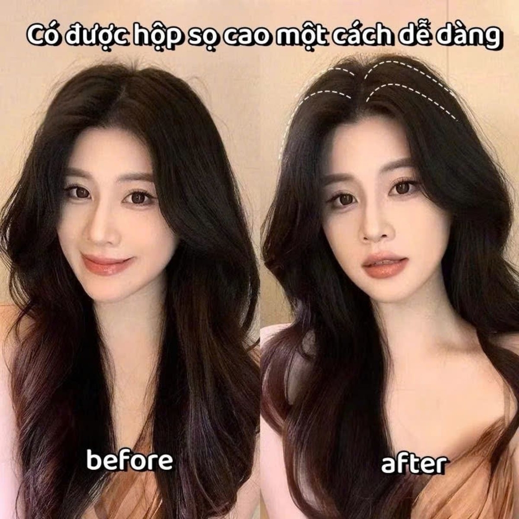 Kẹp Phồng Chân Tóc Tạo Mái Bay Siêu Hot Lược 3 Răng Mái Tóc Dày Dặn Tự Nhiên Phong Cách Hàn Quốc