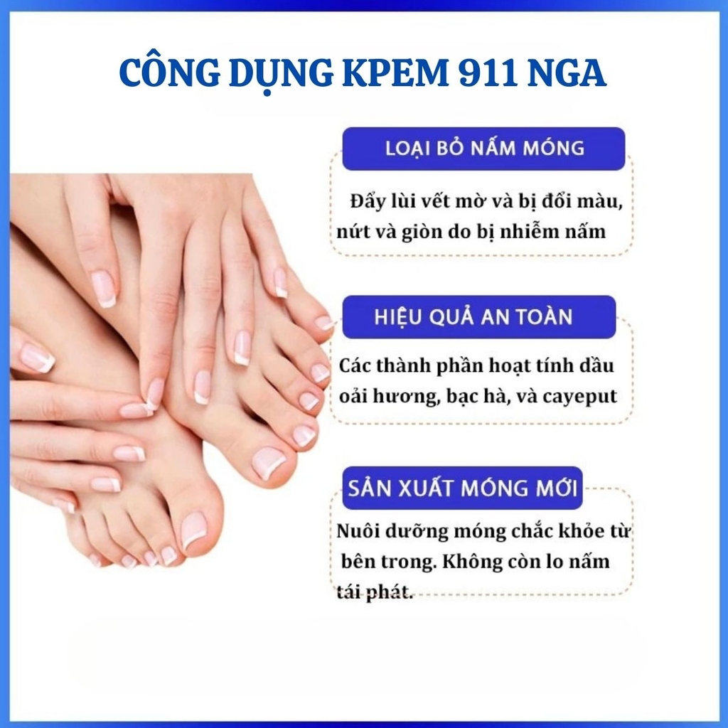 Kem Bôi Giảm Nấm Móng KPEM 911 Diệt Khuẩn Phục Hồi Giúp Móng Chắc Khỏe 30ML Nga
