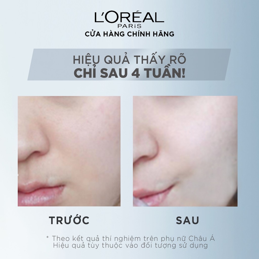 Kem Dưỡng Trắng Da Loreal White Perfect Cream Ngày & Đêm SPF17 PA++ 50ml
