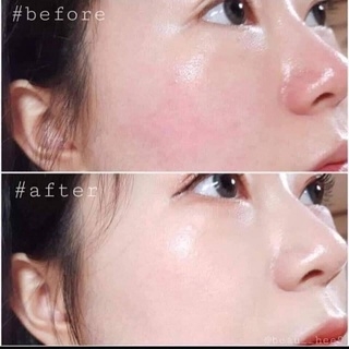 Serum OZ Witch Recipe Filler Aqua Peptide Chai 60ml
