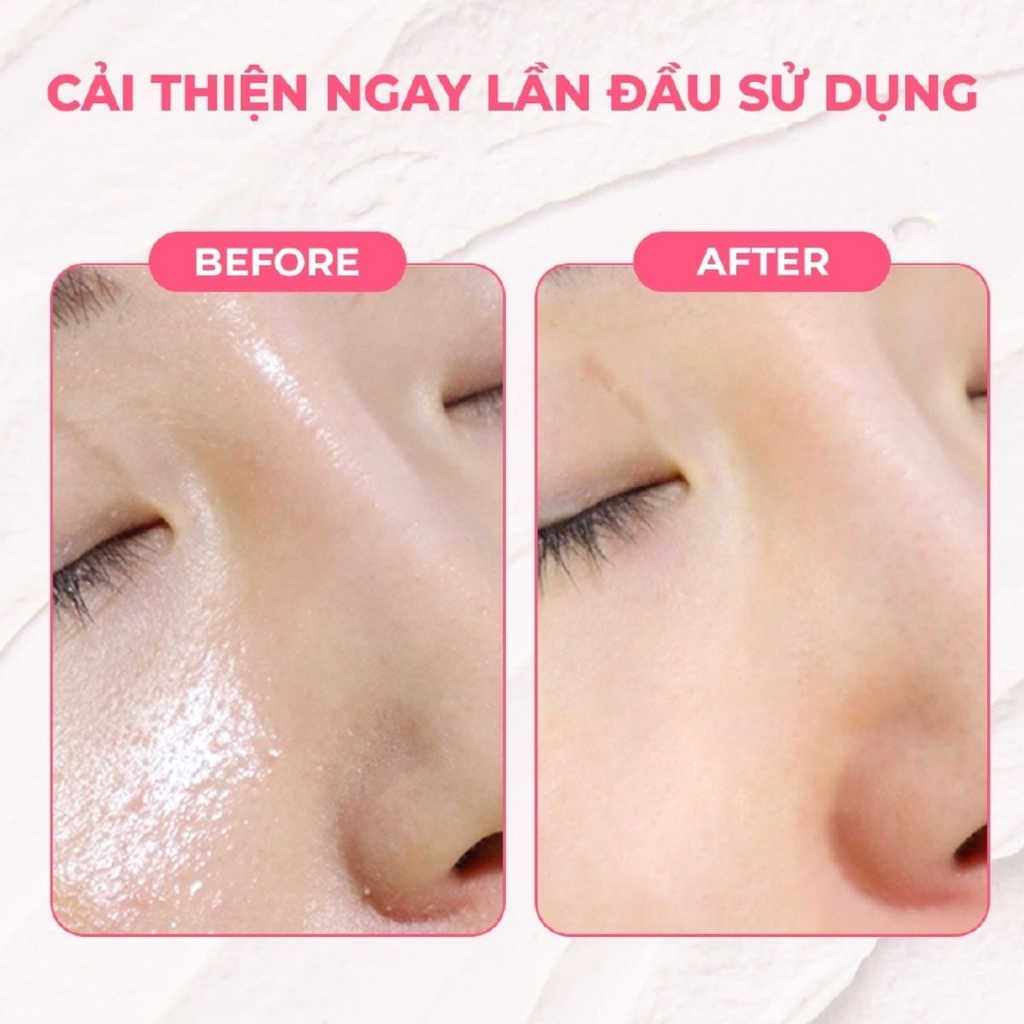 Mặt Nạ Đất Sét Aperire Băng Lạnh Sáng Da Giảm Dầu Se Khít Lỗ Chân Lông Be Frozen Pore Mask Hàn Quốc 120g
