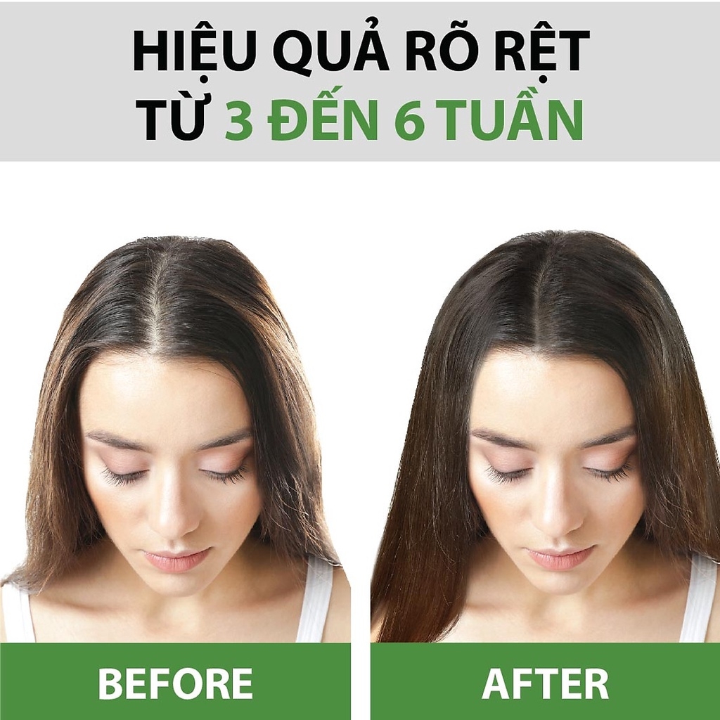 Serum Bưởi Milaganics Giảm Rụng Kích Thích Mọc Tóc - Chai 100ml