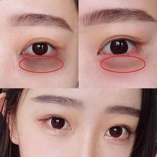 Kem Dưỡng Mắt Dạng Lăn Giảm Thâm Simple Revitalising Eye Roll-On 15ml