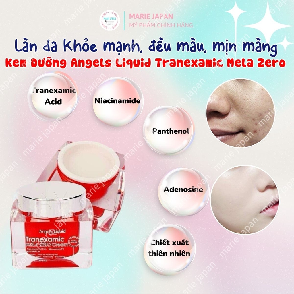 Kem Dưỡng Angel's Liquid Tranexamic Mela Zero Giảm Thâm Nám Dưỡng Trắng Sáng Đều Màu Da Hàn Quốc Chai 30ml