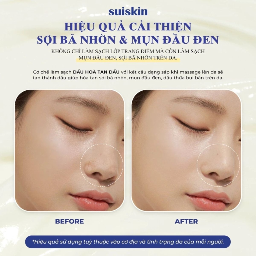 Sáp Tẩy Trang Suiskin Sạch Sâu Loại Bỏ Bã Nhờn Bụi Bẩn Hiệu Qủa Blooming Canola Cleansing Balm Hàn Quốc Hũ 90ml