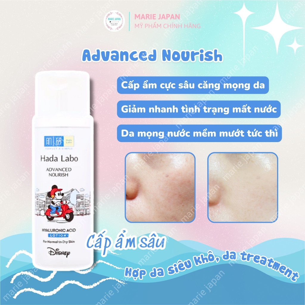 Toner Hada Labo Advanced Nourish Hyaluronic Acid Chai 170ml