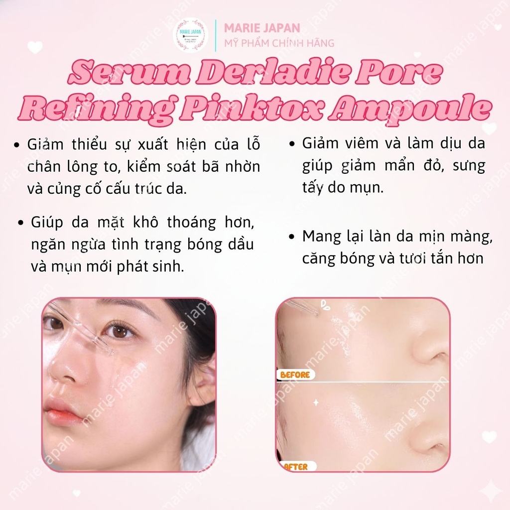Serum Derladie Giảm Mụn Mờ Thâm Sáng Da Se Lỗ Chân Lông Pore Refining Pinktox Ampoule Hàn Quốc Chai 30ml
