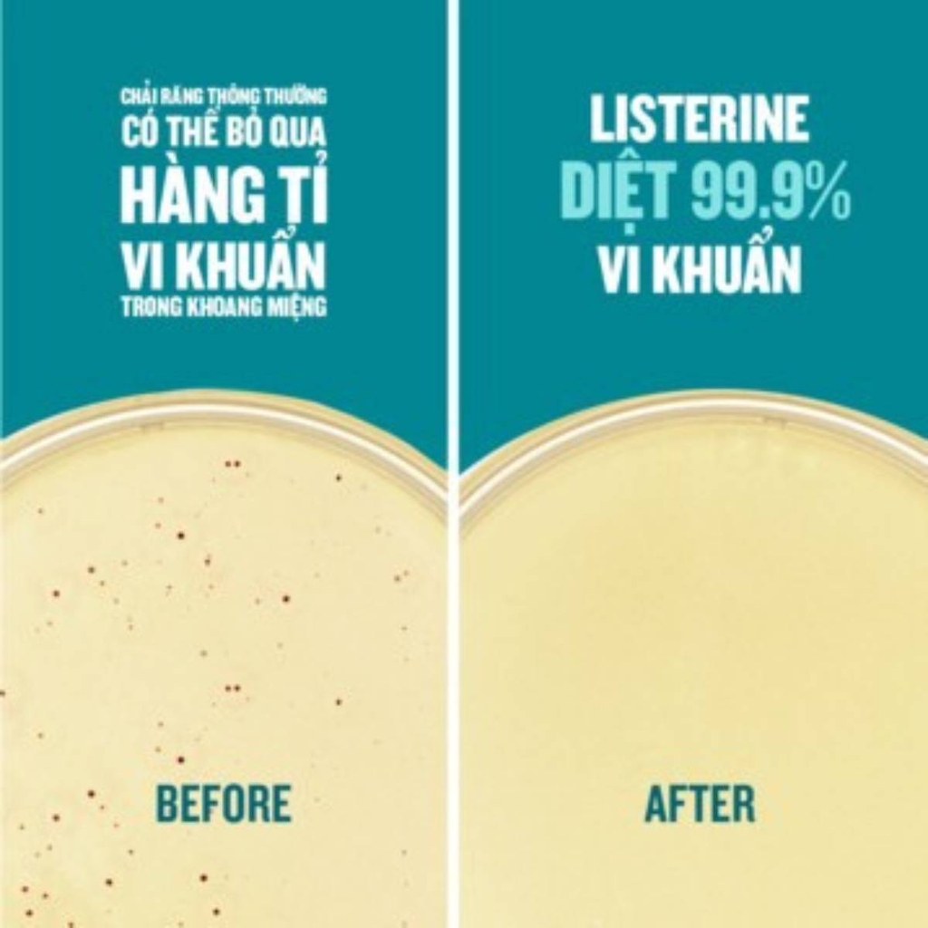 Nước Súc Miệng Listerine Cool Mint Hơi Thở Thơm Mát Ngăn Sâu Răng Viêm Nướu Hương Bạc Hà 750ml