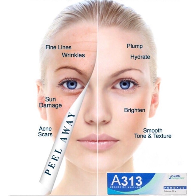 Kem Dưỡng A313 Giảm Mụn Chống Lão Hóa Retinol Cream Pháp 50g