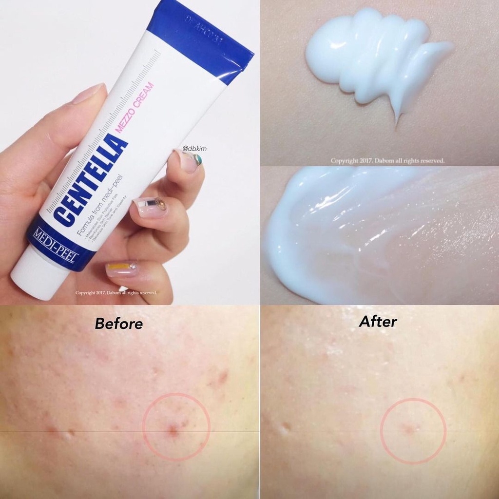 Kem Dưỡng Medi Peel Centella Rau Má Tuýp 30ml