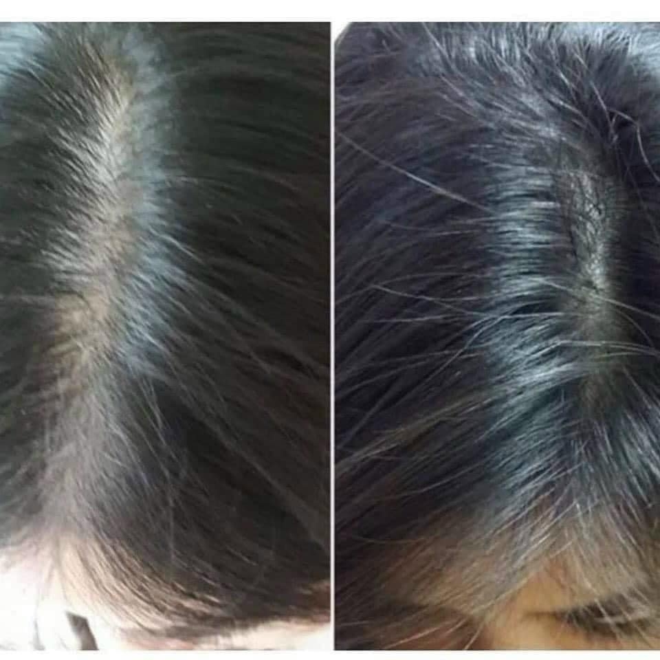 Tinh Chất Chosei Mọc Tóc Nhật Bản Chai 30ml Tặng Kèm Chai Xịt