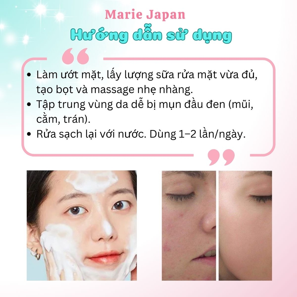 Sữa Rửa Mặt Neutrogena Sạch Sâu Giảm Mụn Siêu Ẩm Mịn Deep Clean Blackhead Eliminating Scrub Tuýp 100G