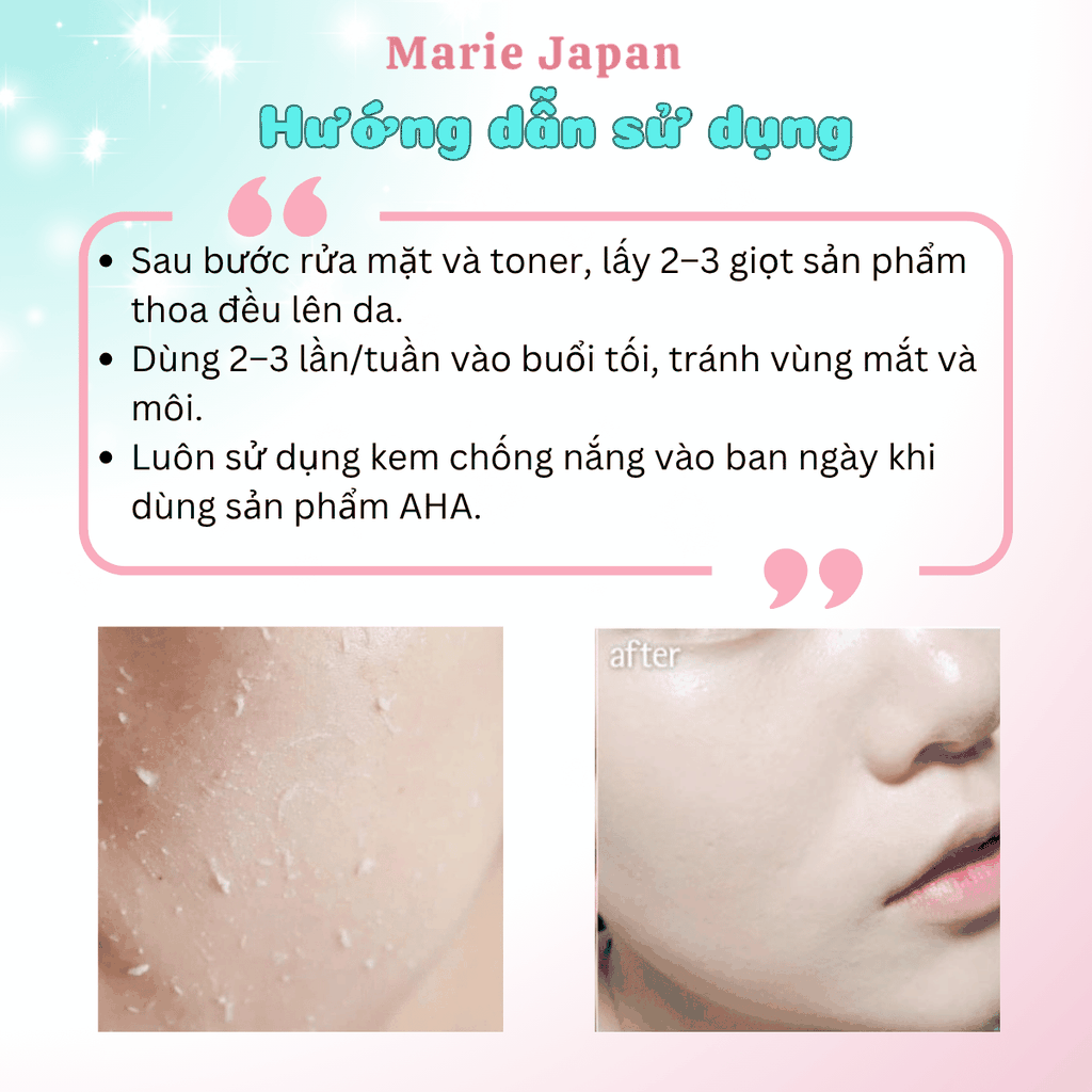 Tẩy Tế Bào Chết MD Care Exfo Mandelic 10%  Sạch Sâu Cấp Ẩm Sáng Da Mờ Thâm 30ML