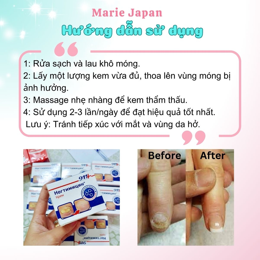 Kem Bôi Giảm Nấm Móng KPEM 911 Diệt Khuẩn Phục Hồi Giúp Móng Chắc Khỏe 30ML Nga